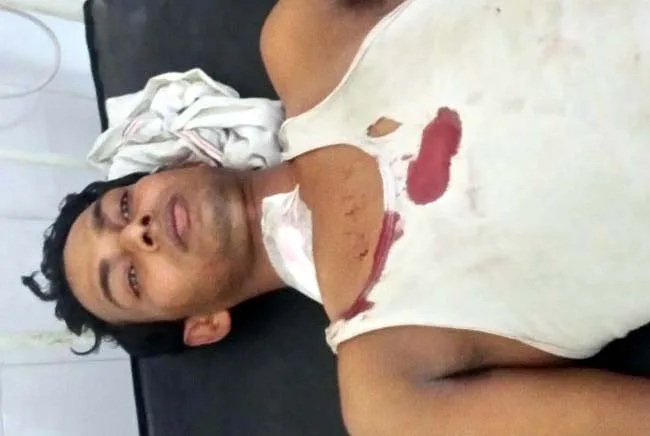 दिनदहाड़े दुकान पर आकर चाकू से किया वार