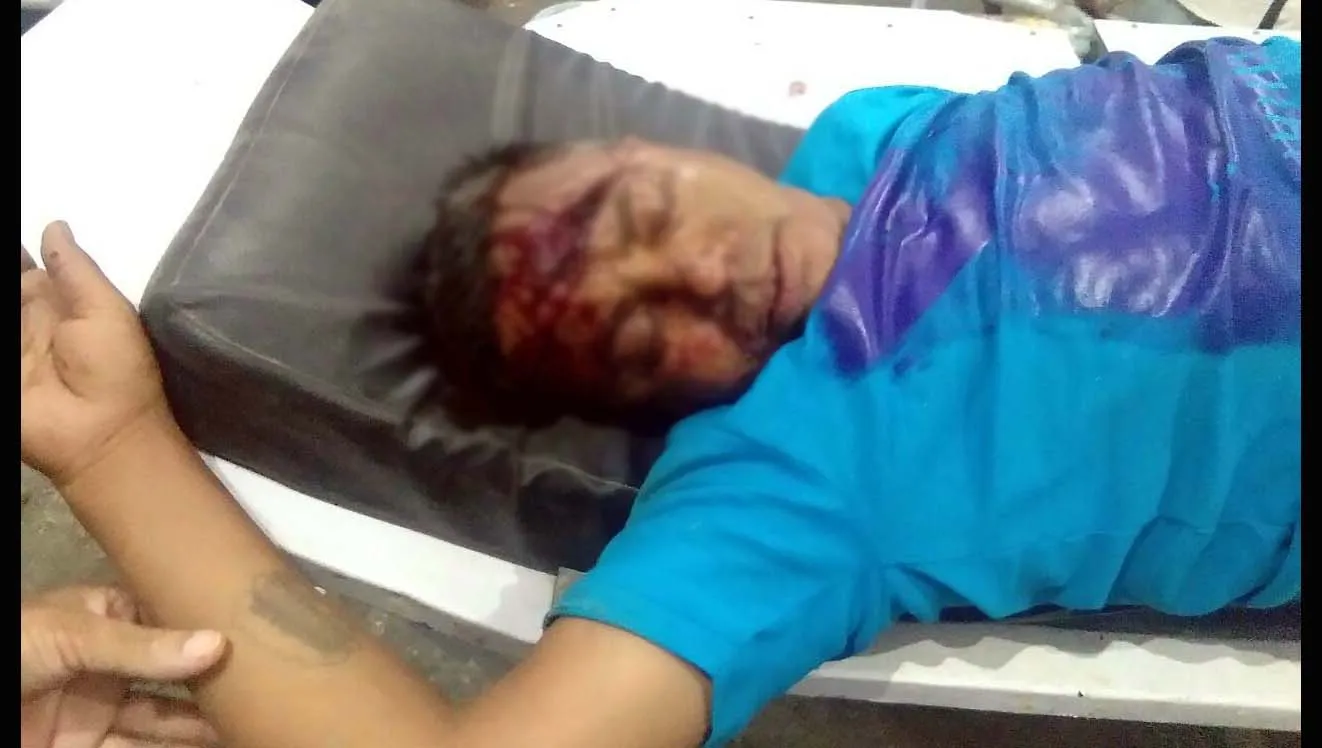 गंभीर घायल ने तोड़ा दम, हत्या की आशंका