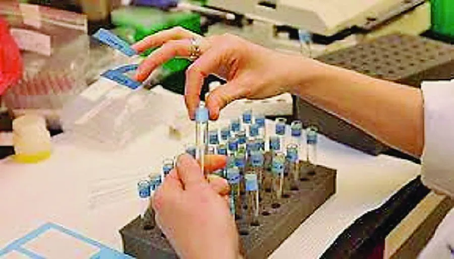 अधिकारी हो या विधायक सबका होगा ‘डोप टैस्ट’
