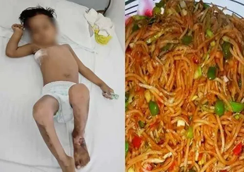 सावधान! चाऊमीन से बच्चे की जान पर बनी, फेफड़ा फटा, पहुँचाया अस्पताल