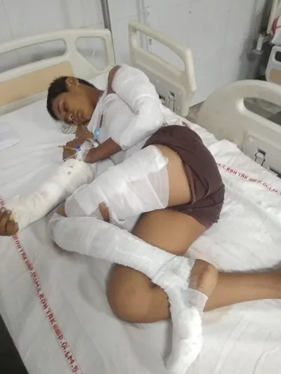 11 हजार वोल्टेज लाइन की चपेट में आया लड़का, गंभीर