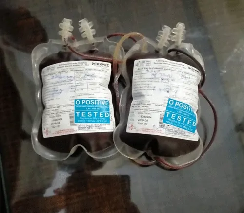 स्वास्थ्य विभाग की लापरवाही के चलते मरीज को लगा 4 दिन बाद ब्लड