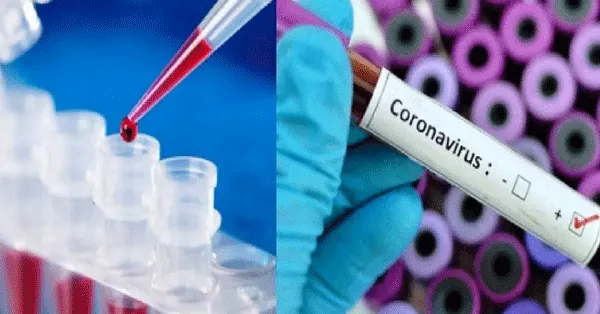 नौ दिन में कोरोना के एक करोड़ से अधिक नमूनों की जांच
