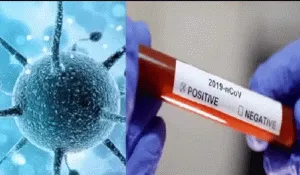 The number of infected in the world is 32 million, Iraq, Iran, airlines will be banned for 15 days