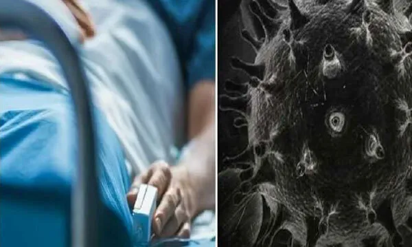 भिवानी ब्लैक फंगस का कहर, 10 मरीज मिले