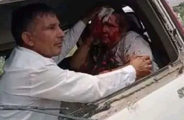 मुख्यमंत्री का विरोध : पुलिस ने किसानों पर भांजी लाठियां, दागे आँसू गैस के गोले