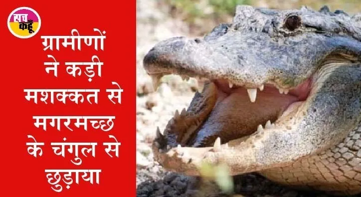मगरमच्छ ने एक व्यक्ति का पैर चबाया, जानें, फिर क्या हुआ…