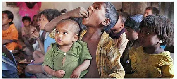 देश में 33 लाख से अधिक बच्चे कुपोषित