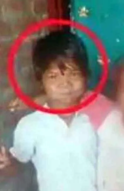 एम्स में पांच साल की ब्रेन डेड बच्ची का लीवर, किडनी व कॉर्निया दान