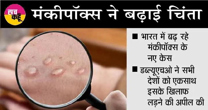 मंकीपॉक्स के विकास को समझने के लिए और अध्ययन की जरूरत: विशेषज्ञ