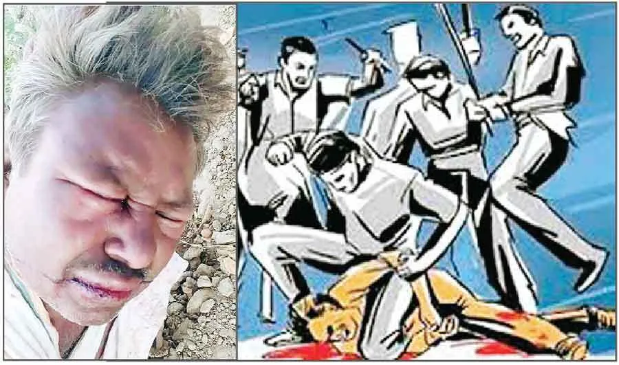 मारपीट कर घायल किया, अस्पताल में भर्ती
