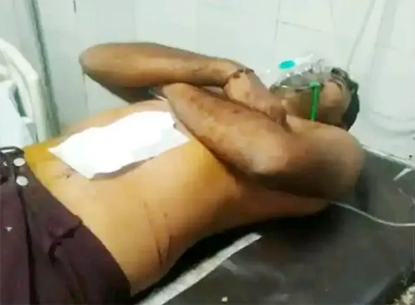 ट्रक ड्राइवर पर लूट के इरादे से चलाई गोली, पेट में लगी