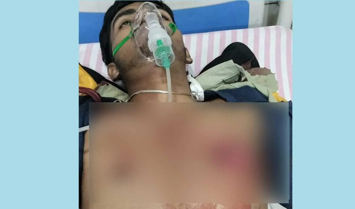 सड़क दुर्घटना में बाइक सवार गंभीर घायल
