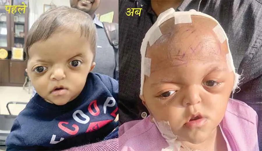 गर्भ में ही विचित्र बीमारी से ग्रस्त बच्चे के लिए फरिश्ता बने डॉक्टर