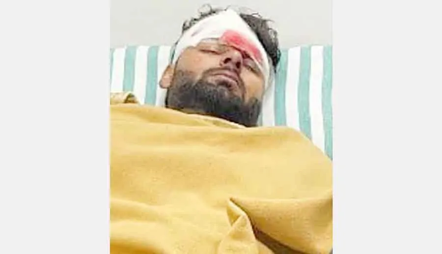 देहरादून से मुंबई एयरलिफ्ट होंगे पंत