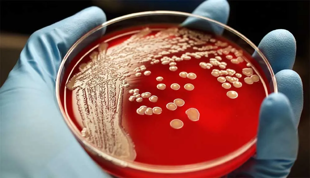 Superbug Bacteria