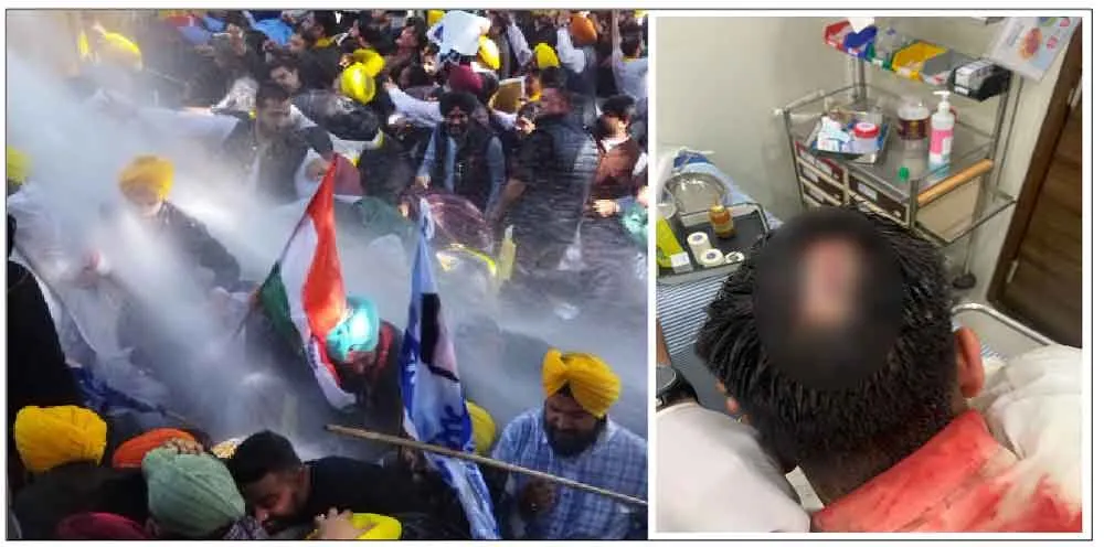 अडानी के खिलाफ ‘आप’ कर रही थी प्रदर्शन, पुलिस ने ‘वाटर कैनन’ से किया स्वागत