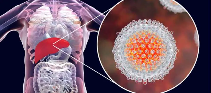 पंजाब में हेपेटाइटिस-सी के मामलों में बढ़ोतरी चिंताजनक: विशेषज्ञ