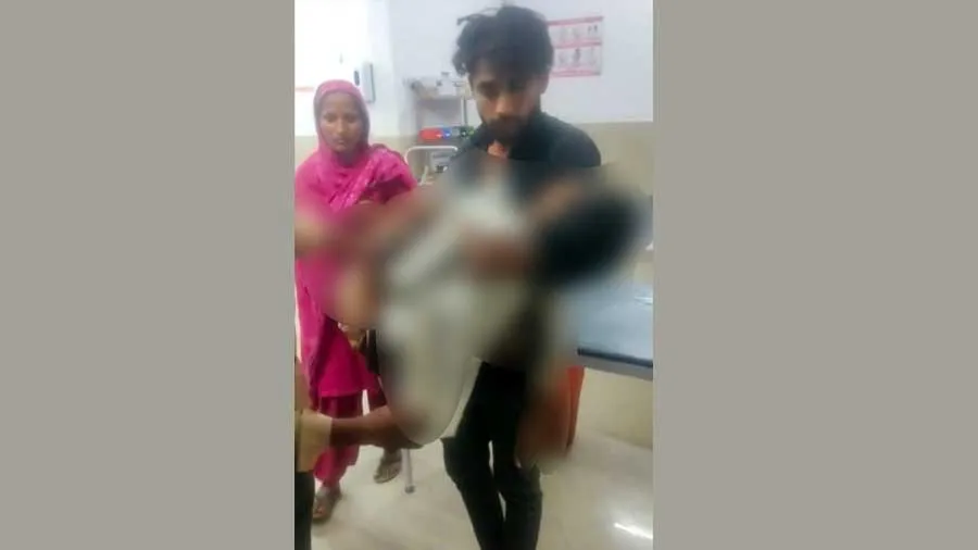 उपचार के लिए सीएचसी पर पहुंचे बालक की मौत