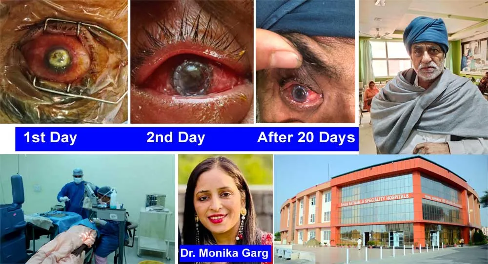 जिस मरीज को दी गई थी पत्थर की आँख लगाने की सलाह, डेरे के अस्पताल में मिली उसे नेत्र ज्योति