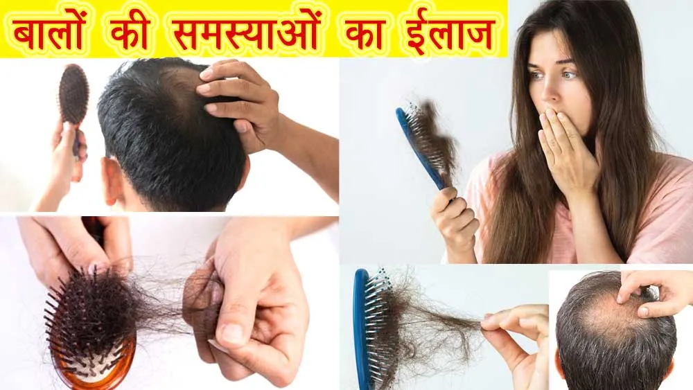 बालों को झड़ने से रोकने के आसान और नेचुरल घरेलू उपाय