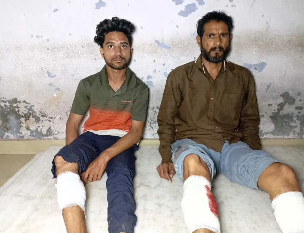कोतवाली पुलिस ने मुठभेड़ के दौरान तीन बदमाशों को किया गिरफ्तार, दो बदमाशों के पैर में लगी गोली