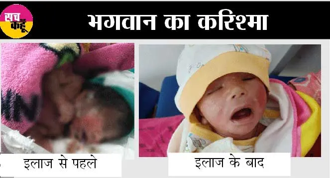 Charisma of God: प्लास्टिक चमड़ी वाले शिशु का पुनर्जन्म