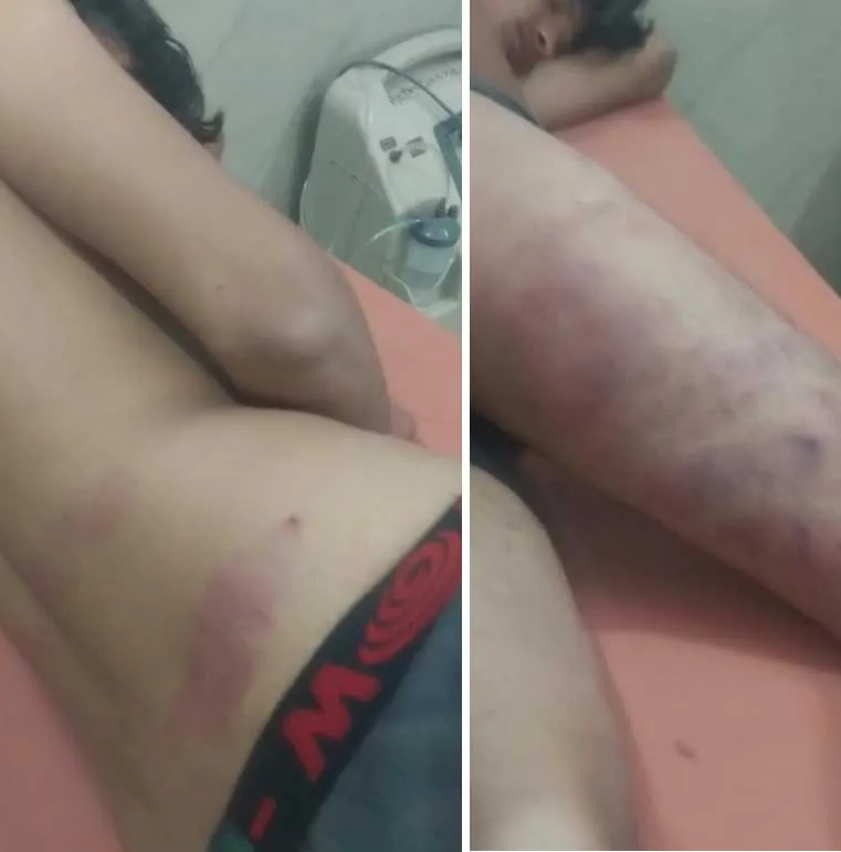 युवक को बेल्ट से बांधकर बेरहमी से पीटा, वीडियो वायरल