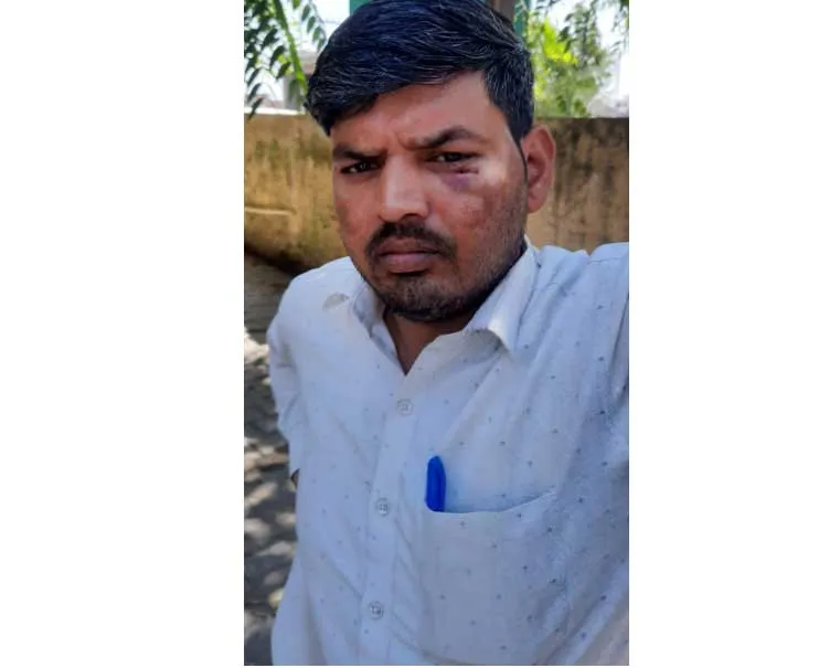 Meerut: 5 दिन पूर्व मारपीट में घायल हुए पीड़ितों का पुलिस ने नहीं किया मुकदमा दर्ज