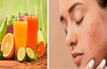 Pimples: चेहरे पर दाग-धब्बों से हो परेशान, तो अपनाएं ये समाधान पीएं ये हर्बल ड्रिंक