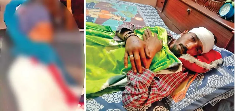 तीन बाईक सवार युवकों ने राह चलते दो युवकों पर डंडों से किया हमला, घायल