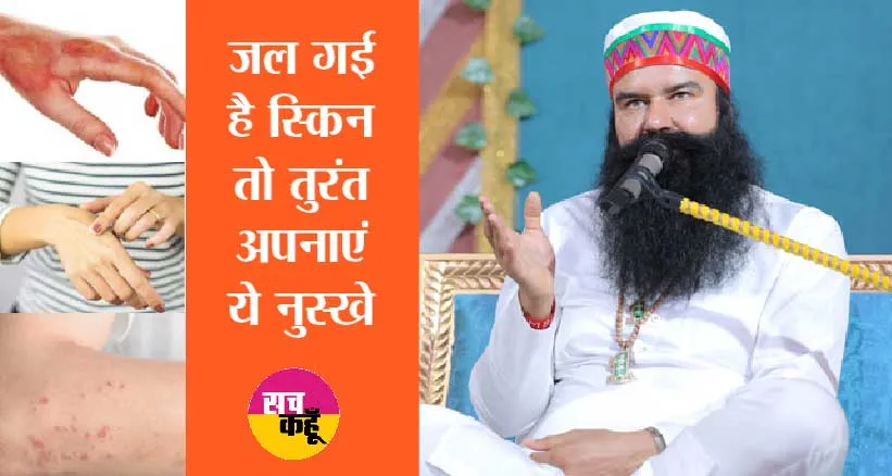 जल गई है स्किन? तुरंत अपनाएं ये घरेलू नुस्खे, मिलेगी राहत