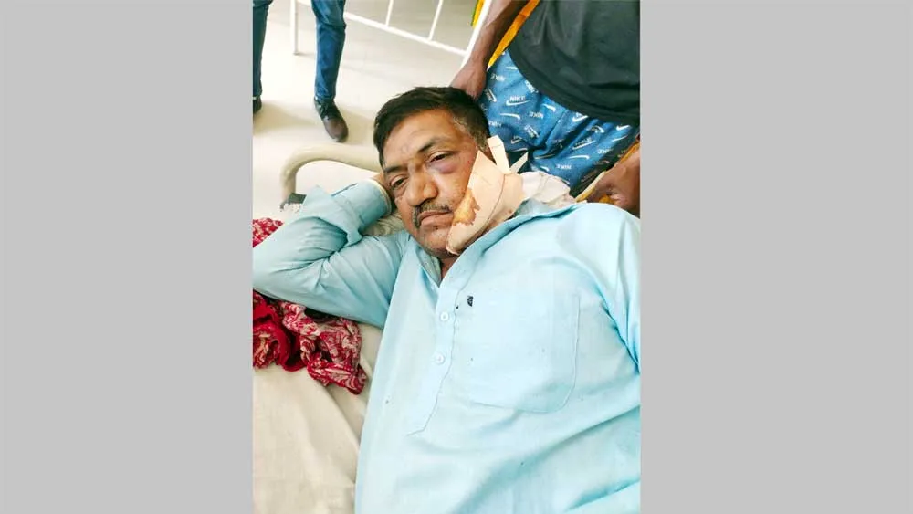 अबोहर में नकाबपोश लुटेरों ने बाइक सवार से बाइक और फोन छीना