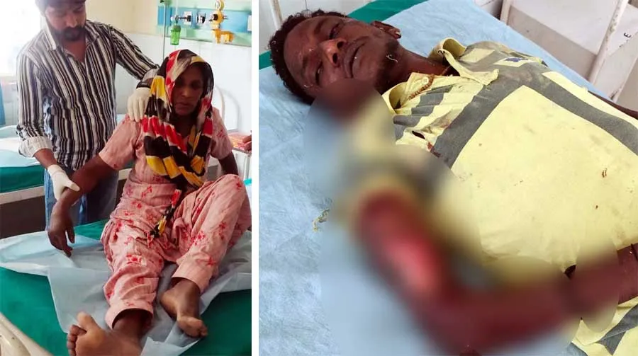 स्कार्पियो ने बाइक सवार को मारी टक्कर