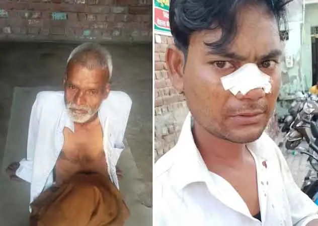 दलित बेटी की शादी में दबंगों की दबंगई,  हंगामा कर की बारातियों की पिटाई