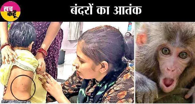 दो साल की बच्ची पर बंदरों ने किया हमला