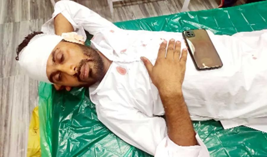 सड़क पर पशु टकराने से युवक घायल, भर्ती