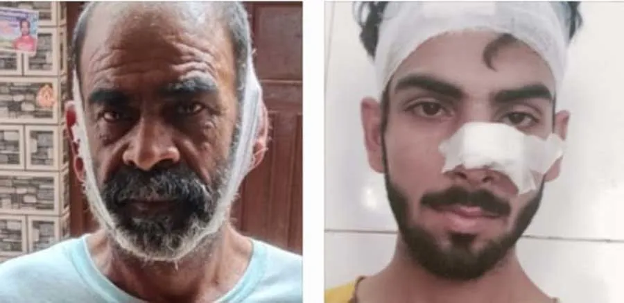 घर में घुसकर मारपीट कर पिता पुत्र को किया घायल