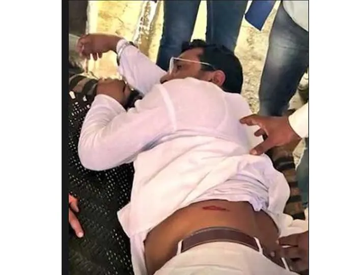चंद्रशेखर आजाद को देवबंद में मारी गई गोली, अस्पताल में भर्ती