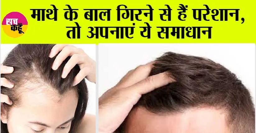 Hair Fall Remedy: बार-बार देखो, चाहे हजार बार देखो! ये तो ऐसे ही रहेंगे!