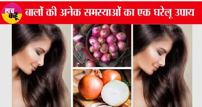 DIY Onion Oil at Home: बालों की अनेक समस्याओं का एक घरेलू उपाय, बनाये प्याज़ का तेल आसान तरीके से