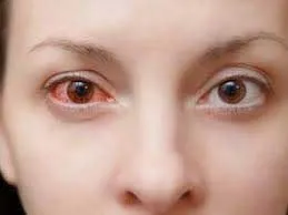 Eye Care Tips