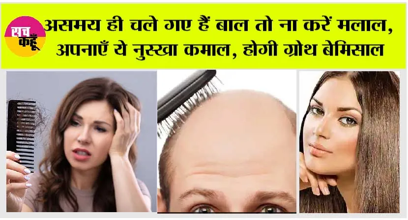 Hair Care: असमय ही चले गए हैं बाल तो ना करें मलाल, अपनाएँ ये नुस्खा कमाल, होगी ग्रोथ बेमिसाल