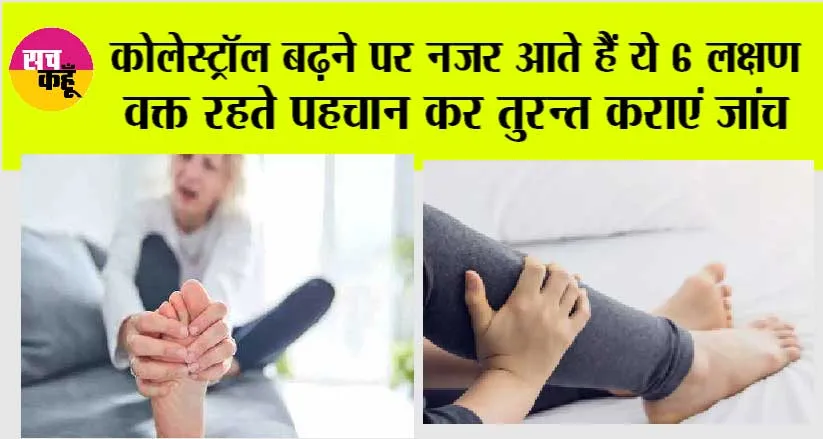 High Cholesterol Signs: कोलेस्ट्रॉल बढ़ने पर नजर आते हैं ये 6 लक्षण, वक्त रहते पहचान कर तुरन्त कराएं जांच