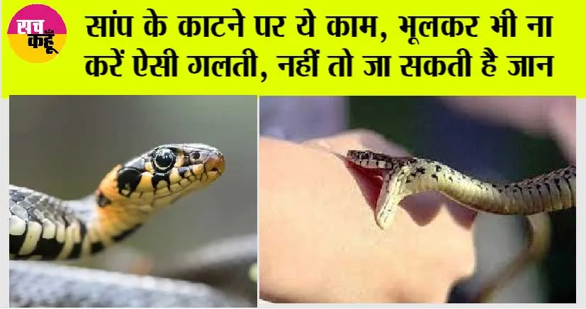 Snake Bite: सांप के काटने पर ये काम, भूलकर भी ना करें ऐसी गलती, नहीं तो जा सकती है जान