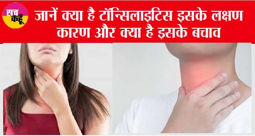 Tonsillitis: जानें क्या है टॉन्सिलाइटिस इसके लक्षण कारण और क्या है इसके बचाव