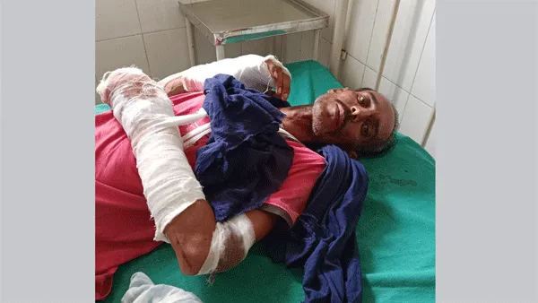 बाइक सवार युवक से टकराया आवारा पशु