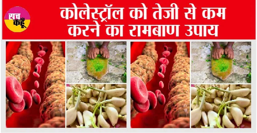 Cholesterol Control Foods: कोलेस्ट्रॉल को तेज़ी से कम करने का रामबाण उपाय
