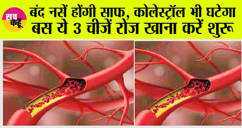Cholesterol Control: बंद नसें होंगी साफ़, कोलेस्ट्रॉल भी घटेगा, बस ये 3 चीज़ें रोज़ खाना करें शुरू