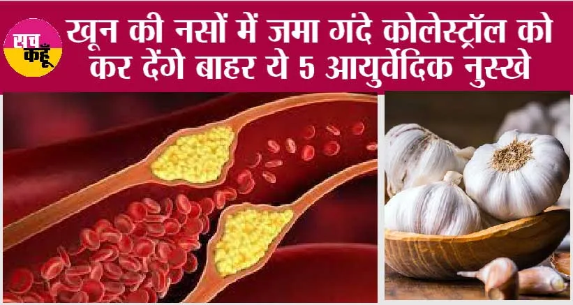 Control Bad Cholesterol: खून की नसों में जमा गंदे कोलेस्ट्रॉल को कर देंगे बाहर ये 5 आयुर्वेदिक नुस्खे